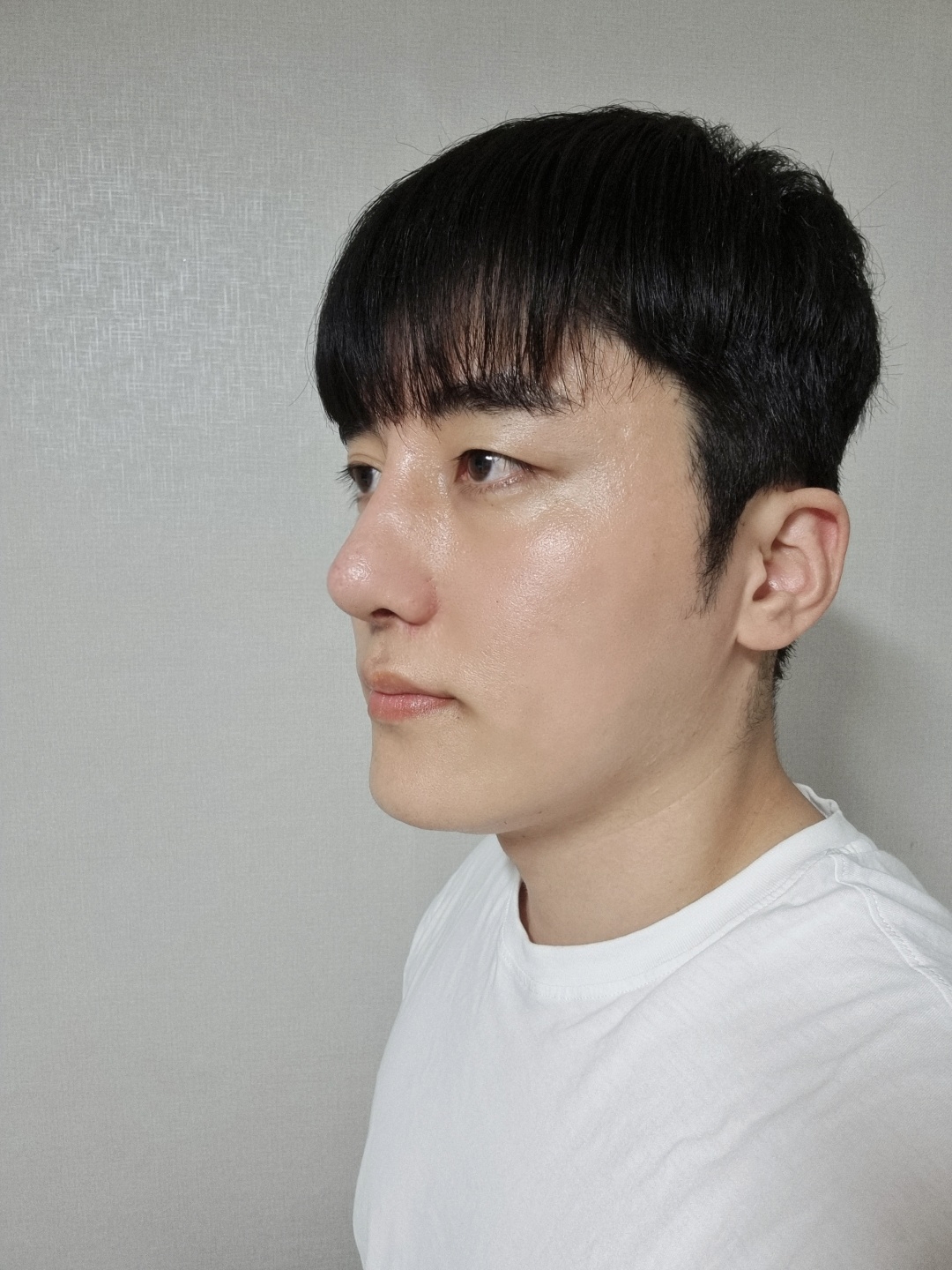 수술후기이미지