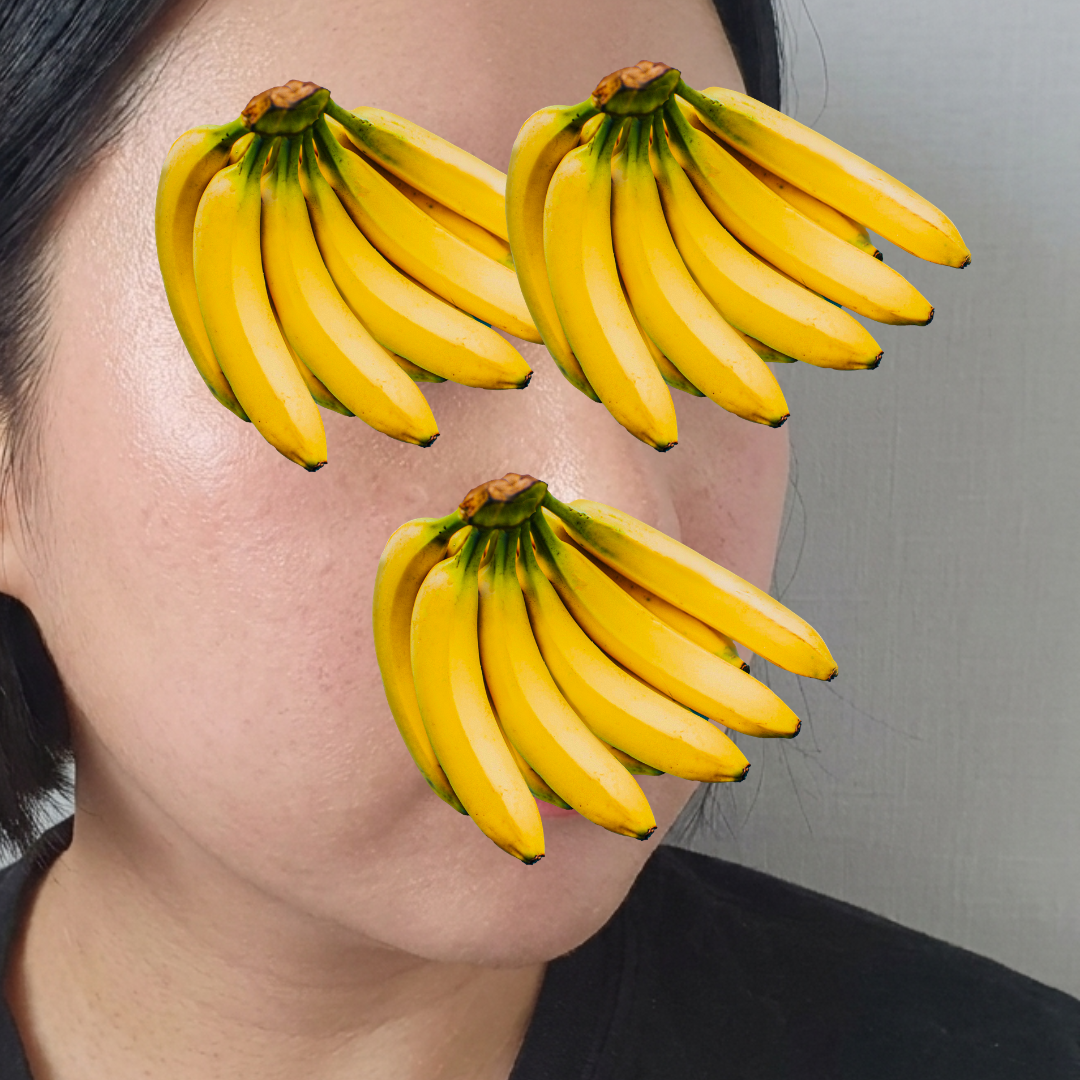 수술후기이미지