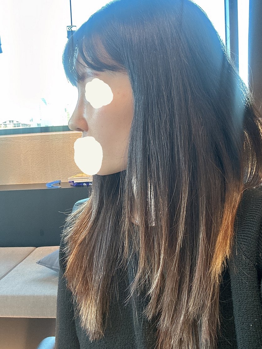 수술후기이미지