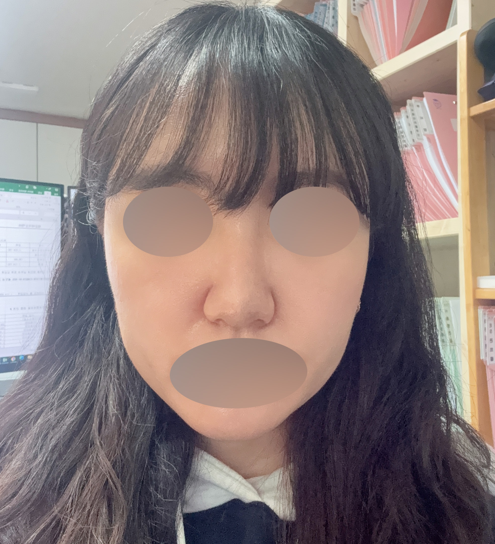 수술후기이미지