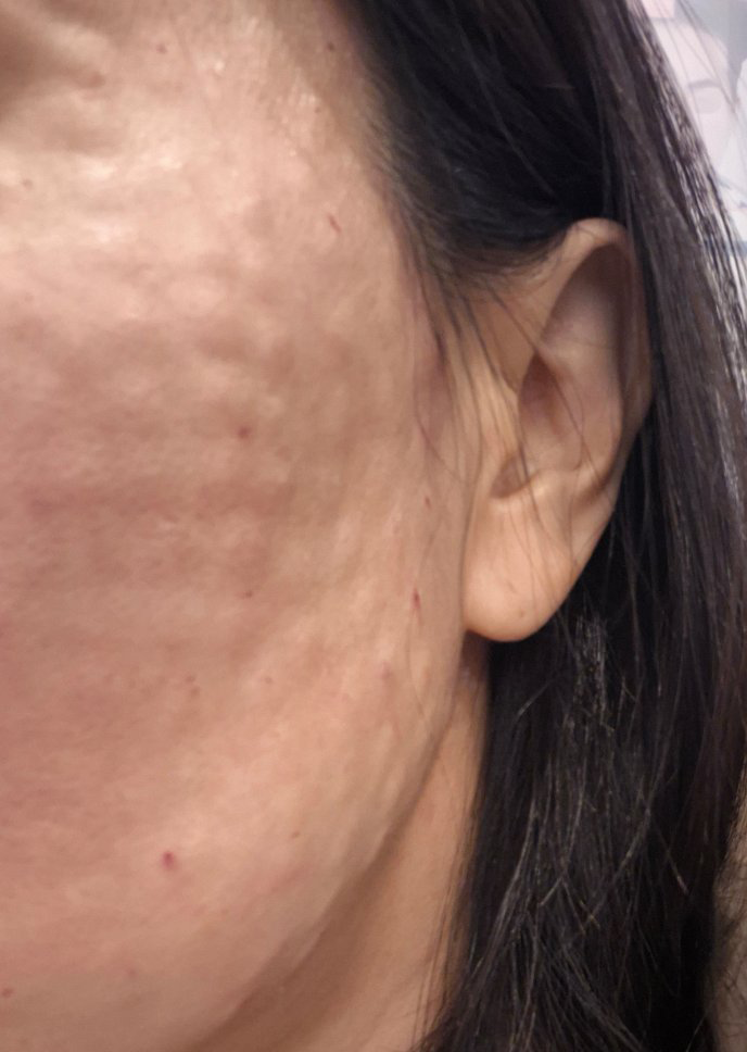 수술후기이미지