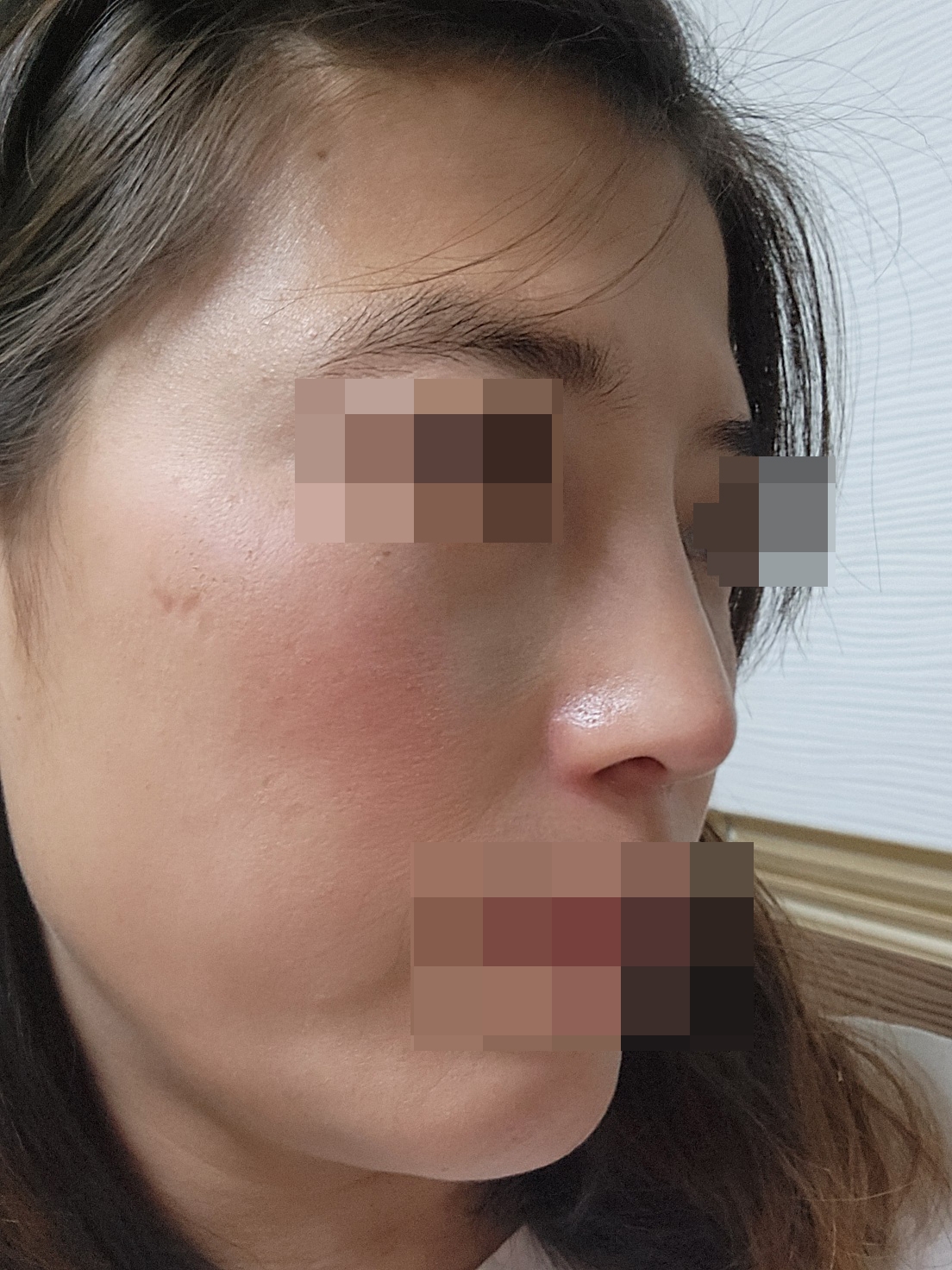 수술후기이미지