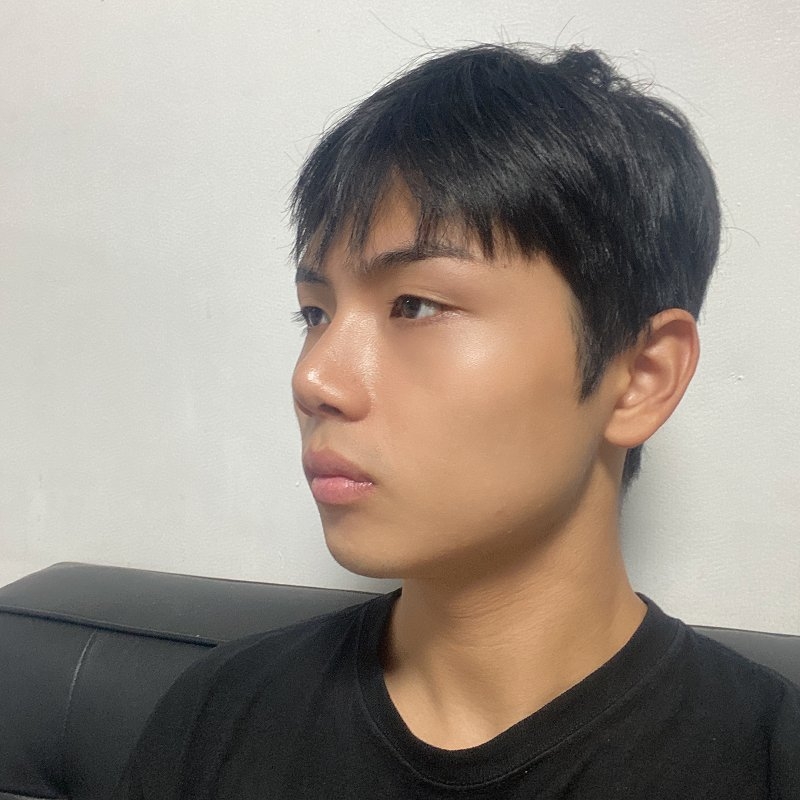 수술후기이미지