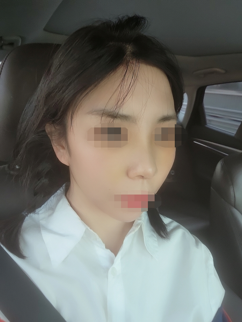 수술후기이미지