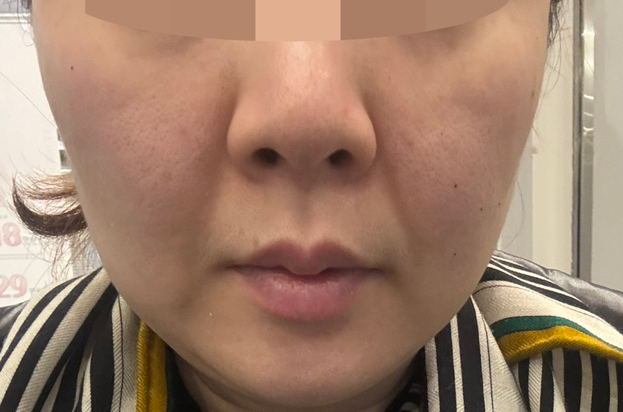 수술후기이미지