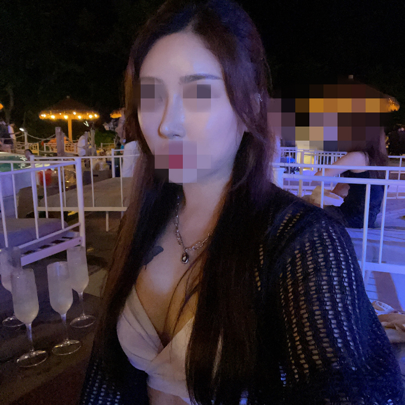 수술후기이미지