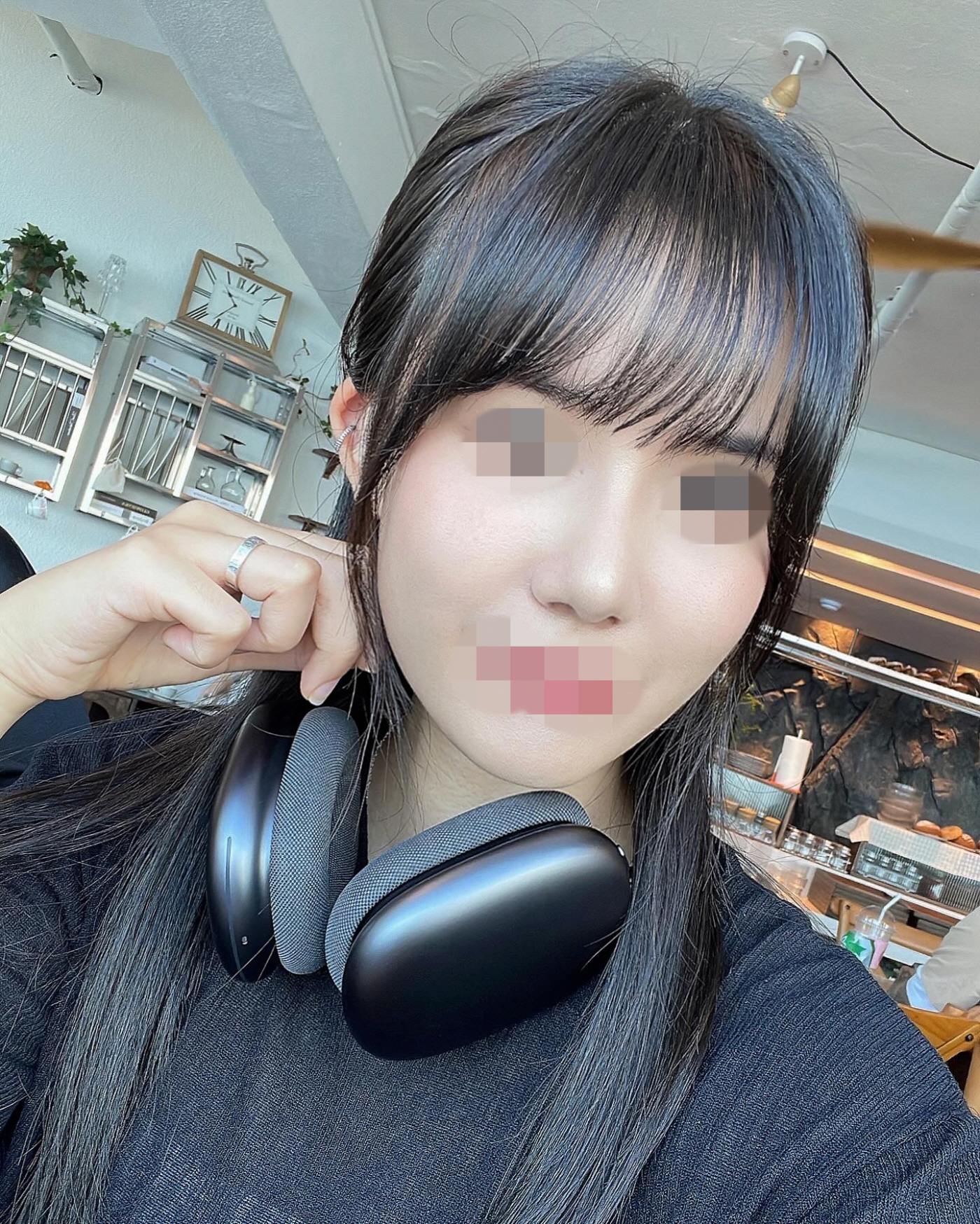 수술후기이미지