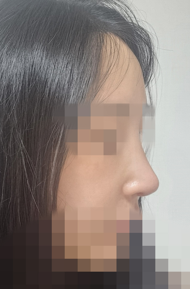 수술후기이미지