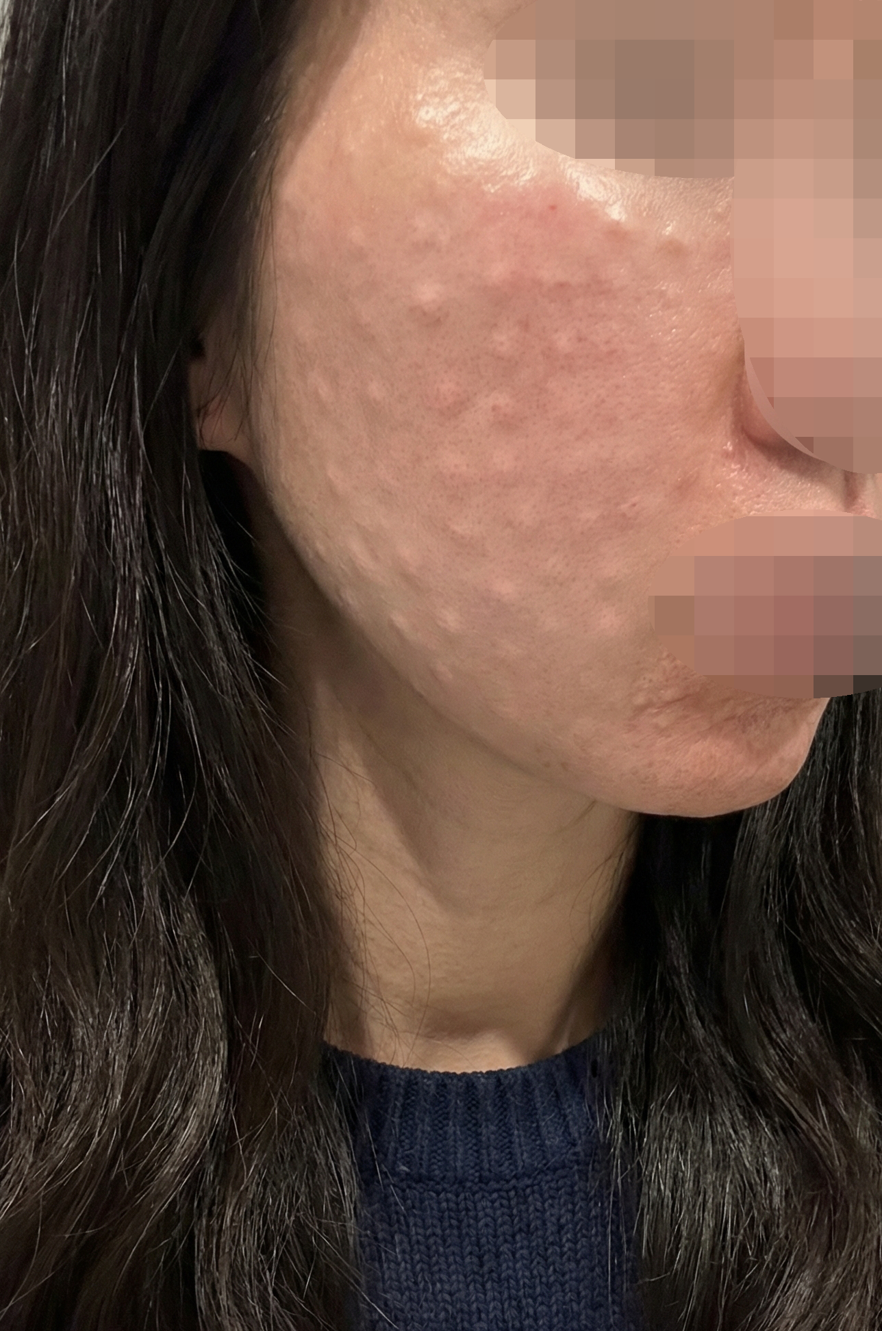 수술후기이미지