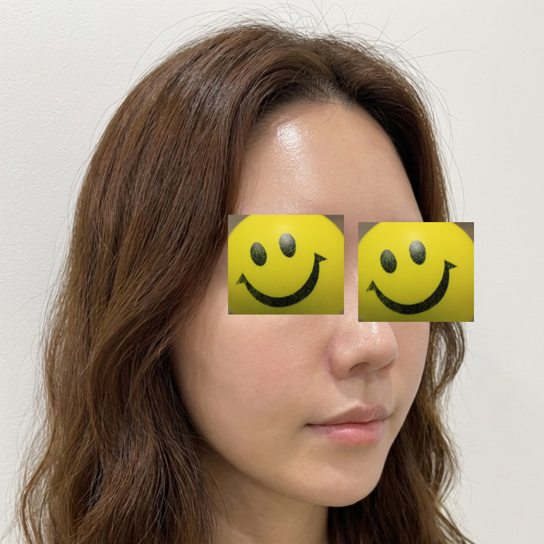 수술후기이미지