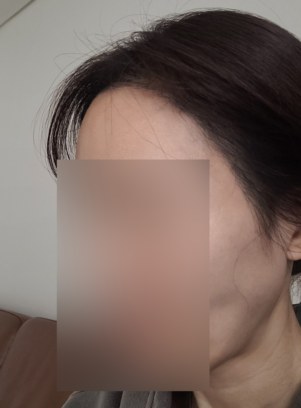 수술후기이미지