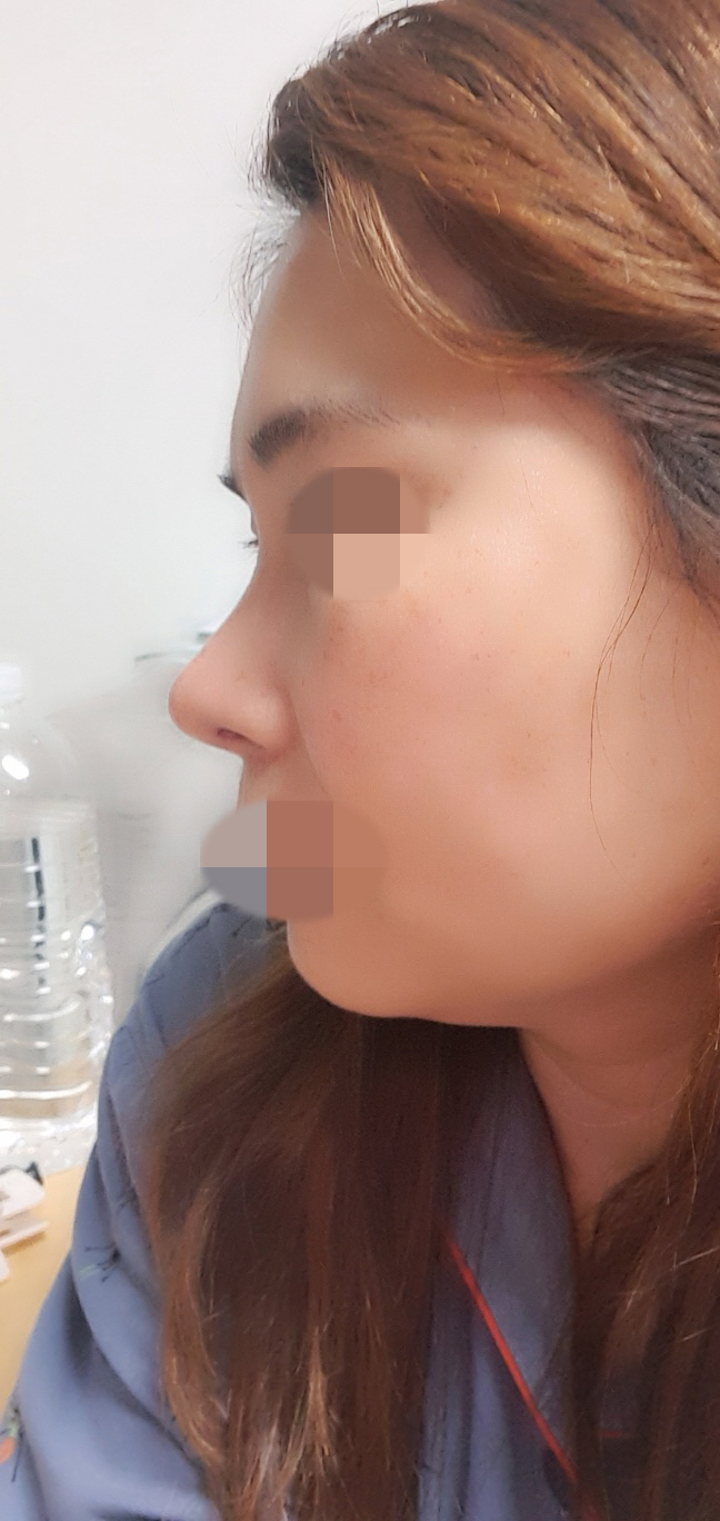 수술후기이미지