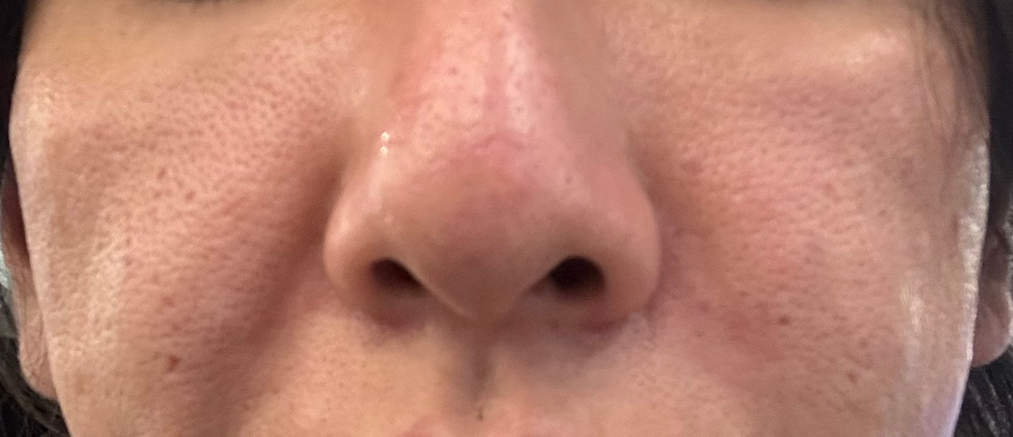 수술후기이미지