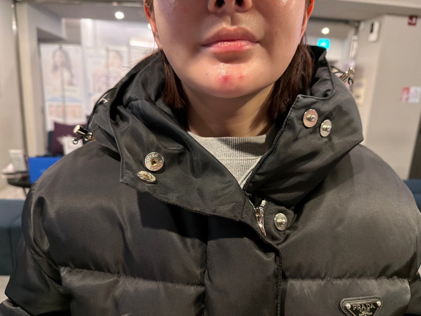 수술후기이미지