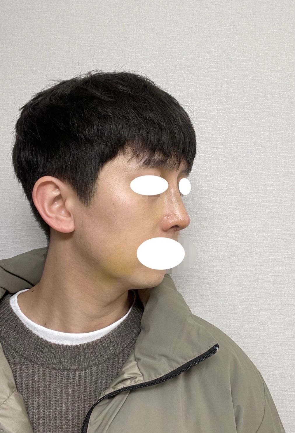 수술후기이미지