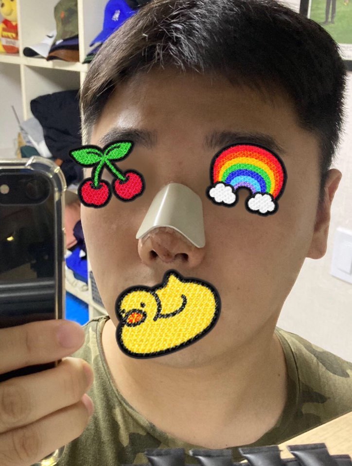 수술후기이미지