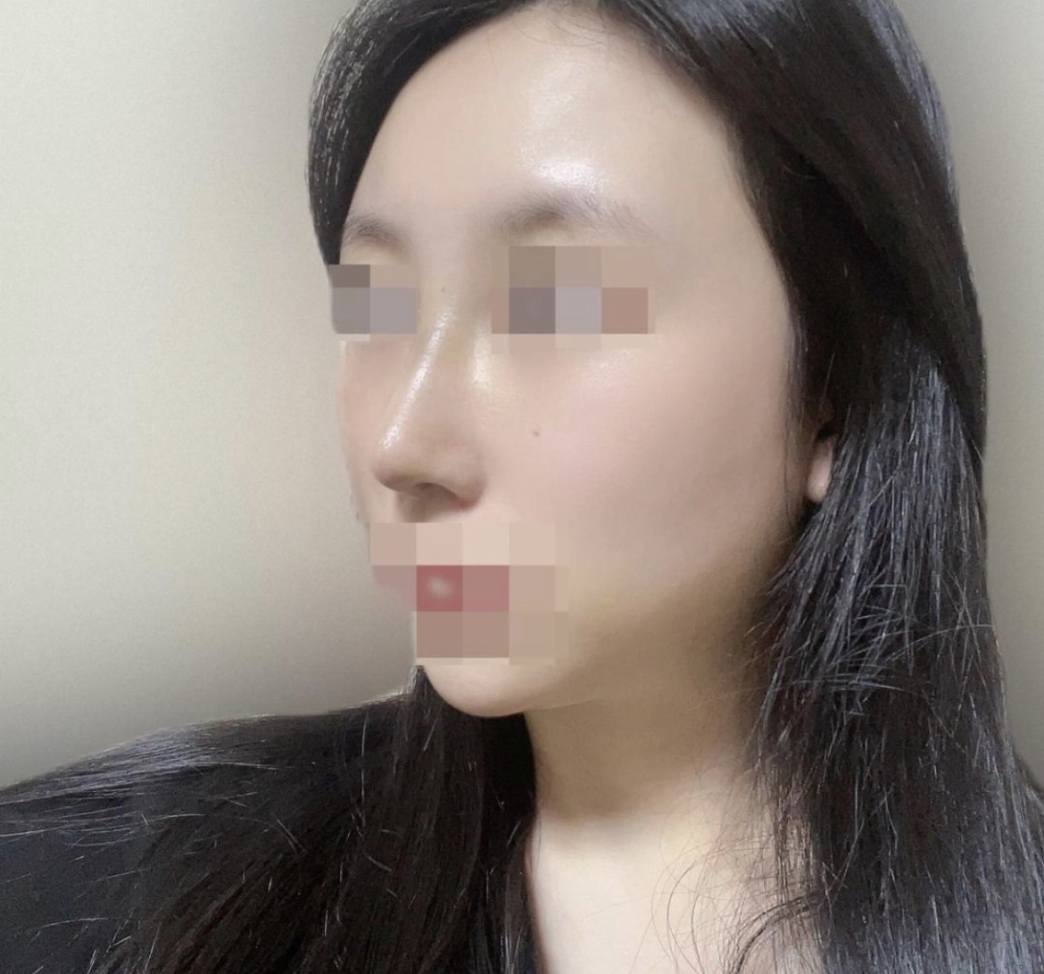 수술후기이미지