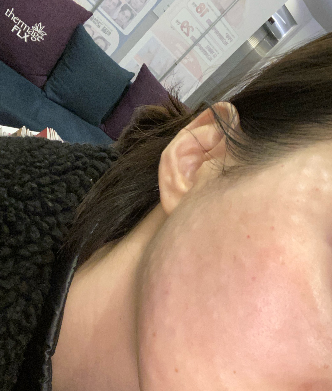 수술후기이미지