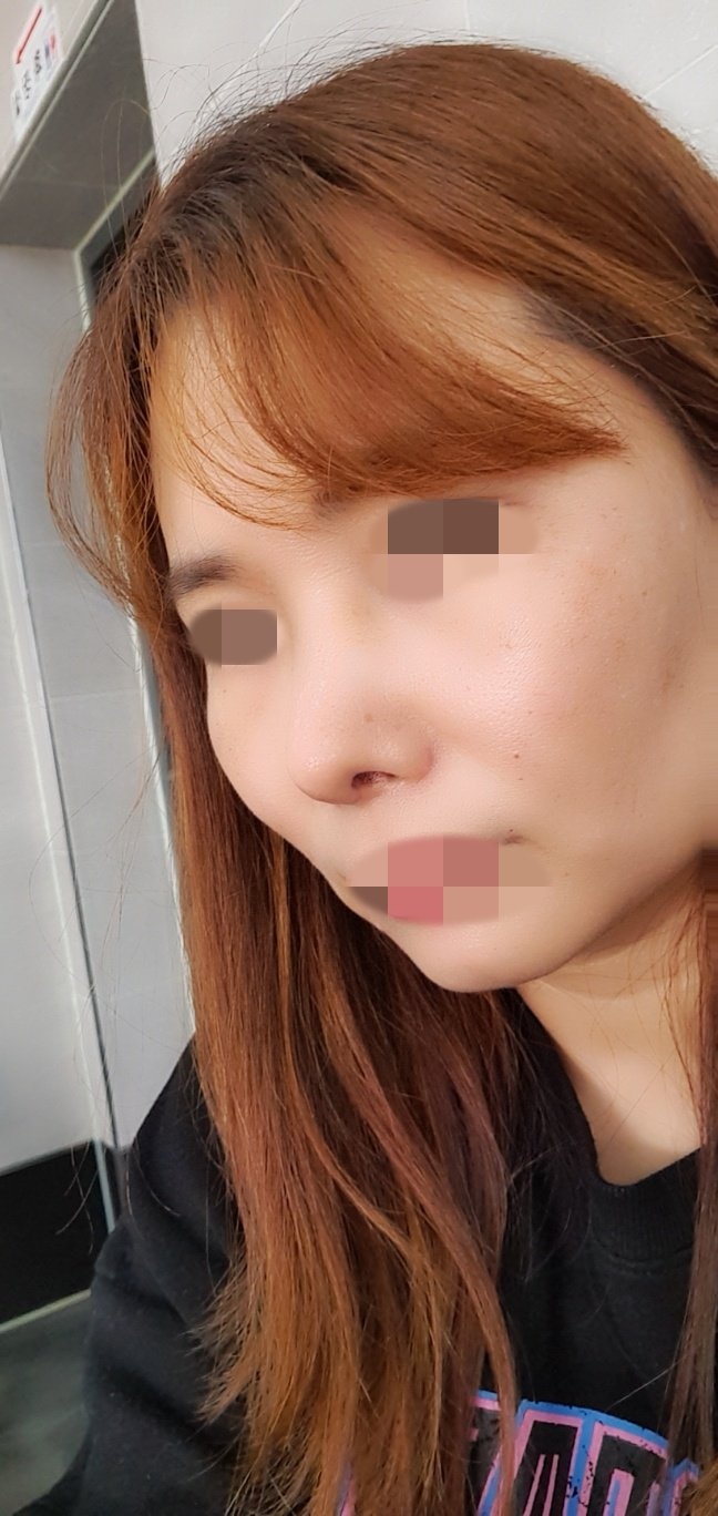 수술후기이미지