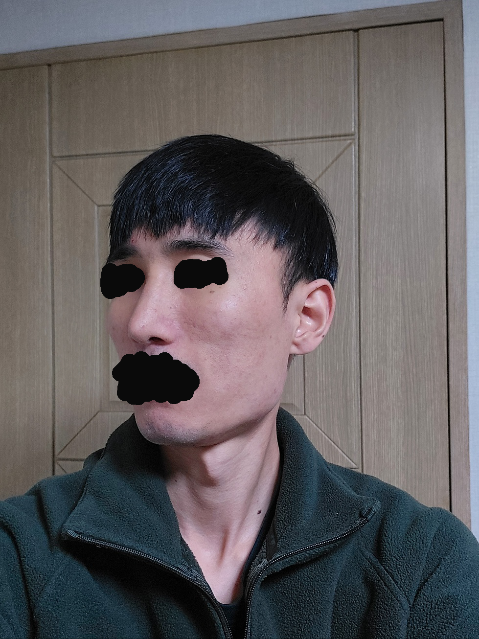 수술후기이미지