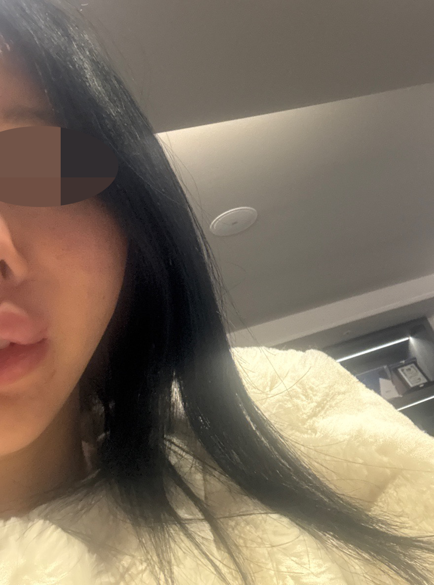 수술후기이미지