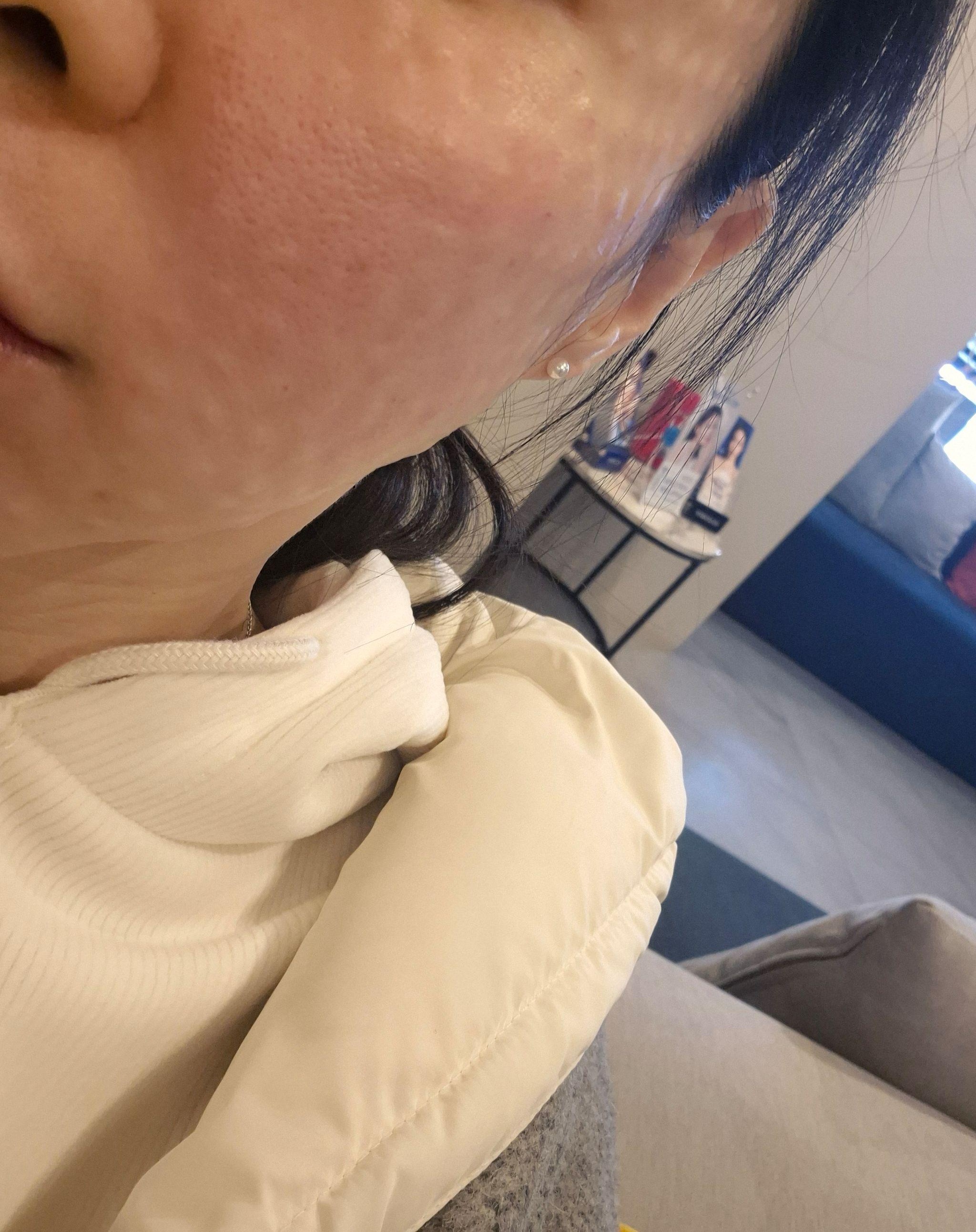 수술후기이미지