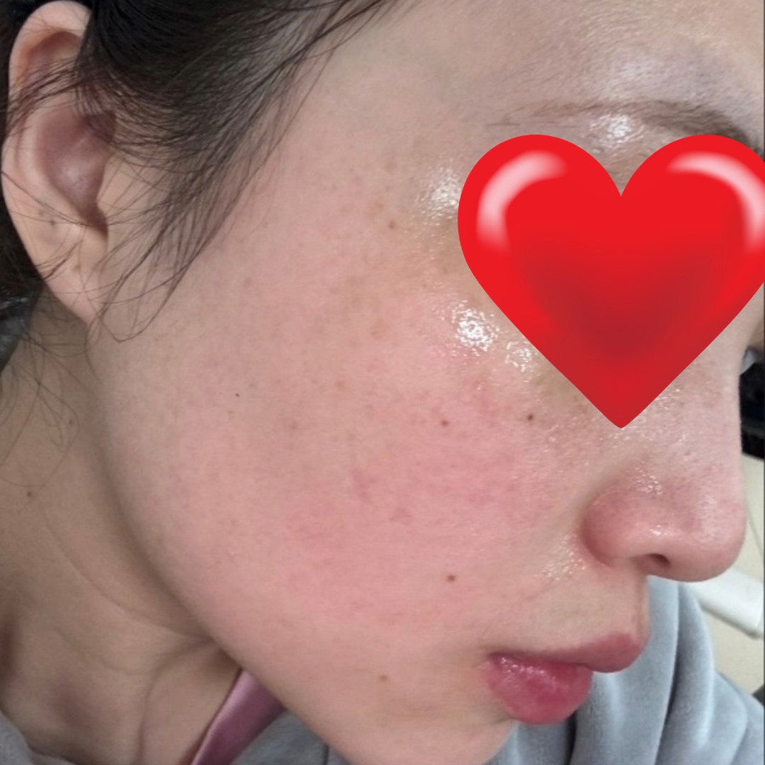 수술후기이미지