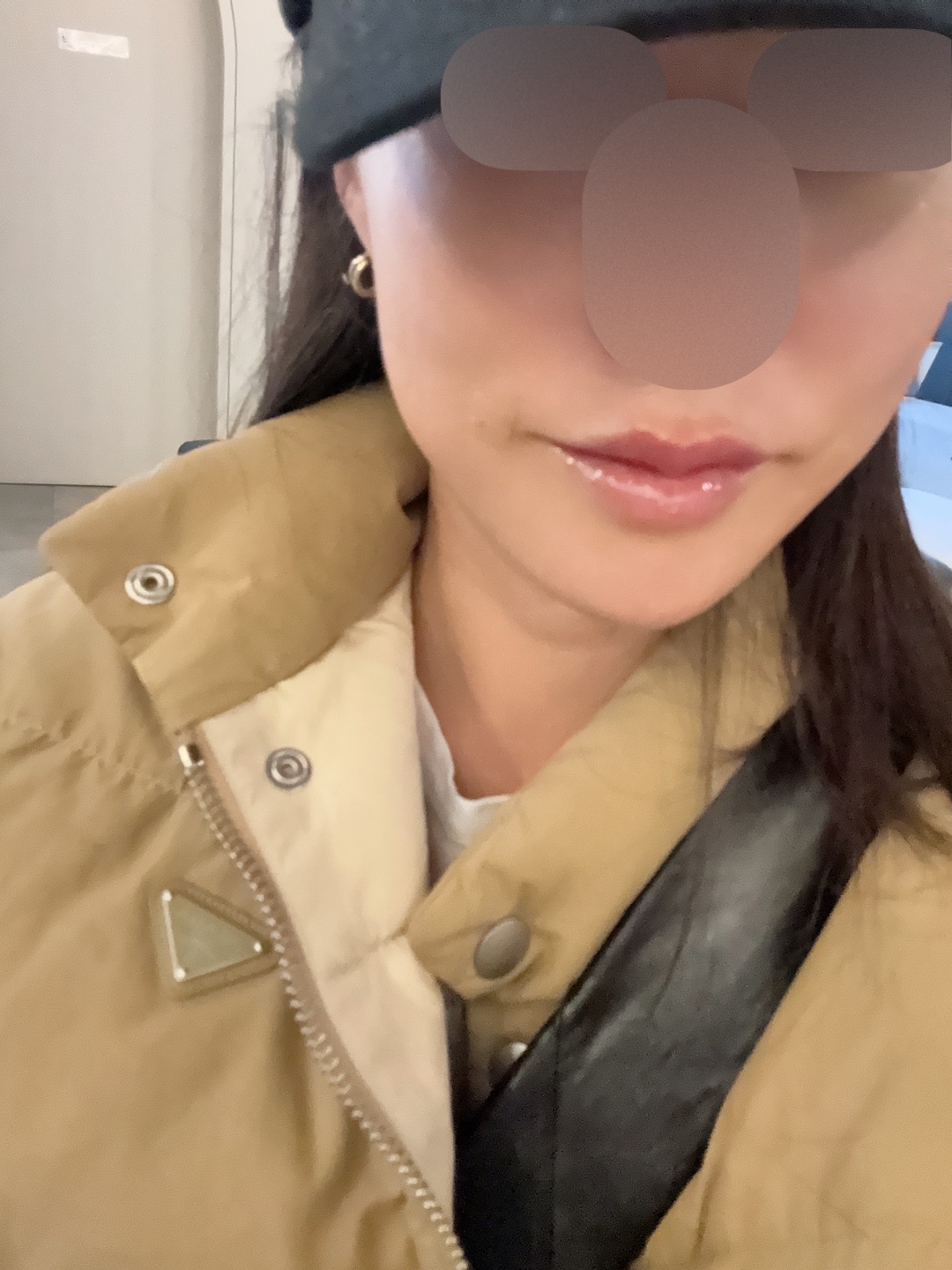 수술후기이미지