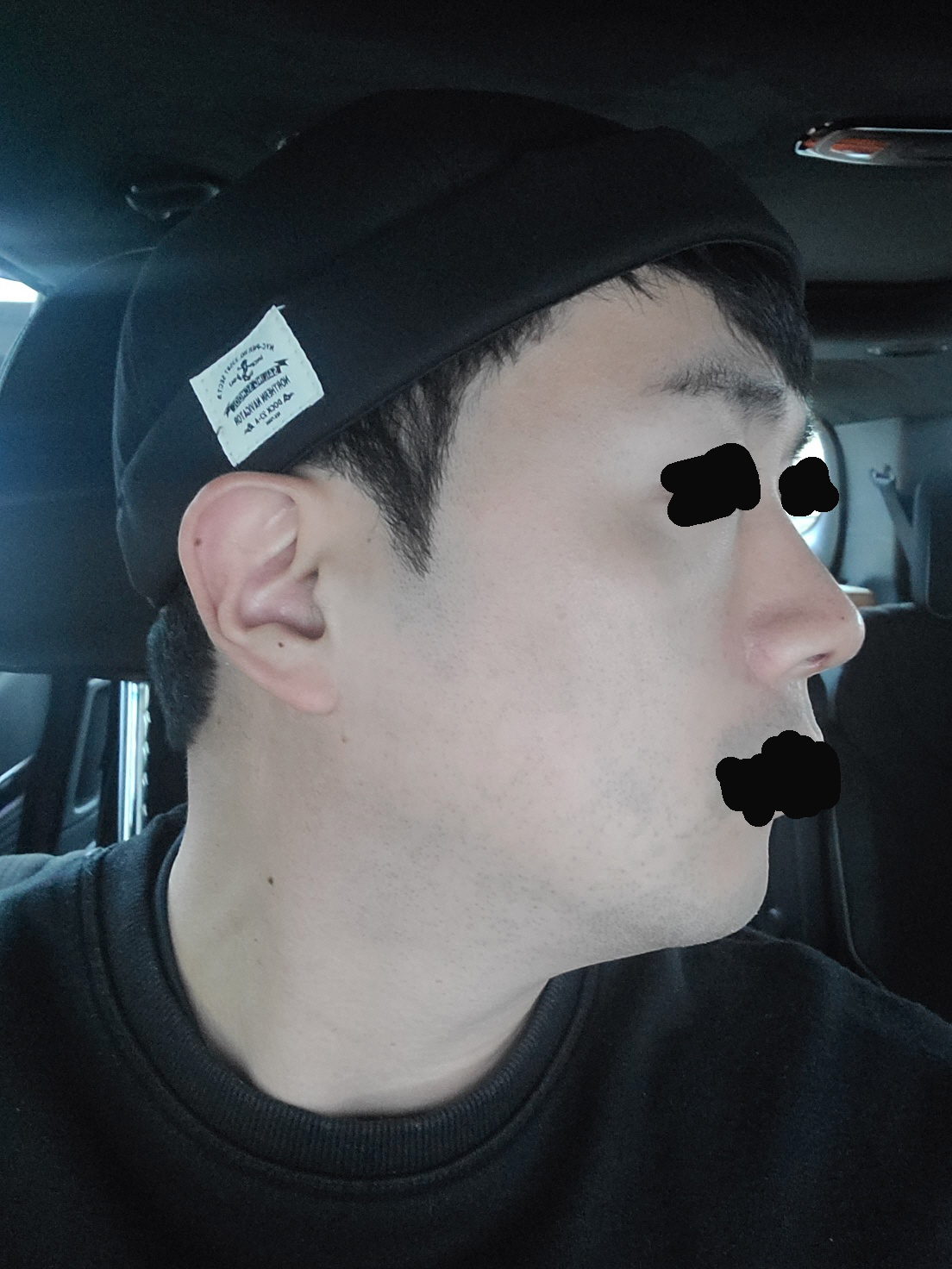 수술후기이미지