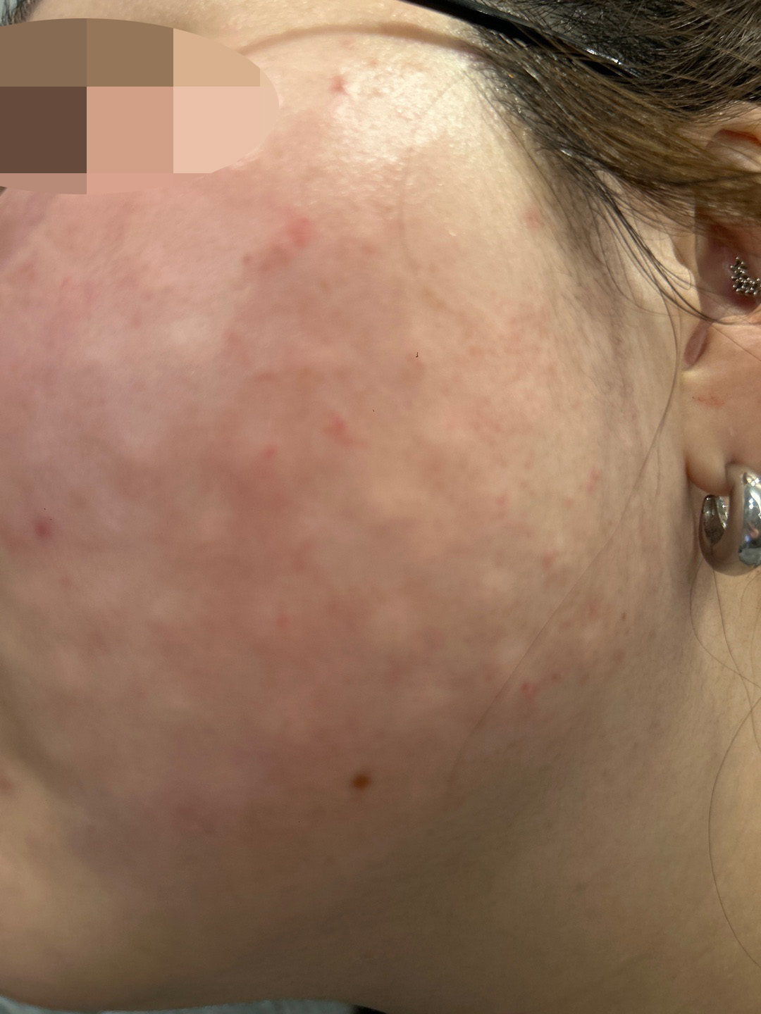 수술후기이미지