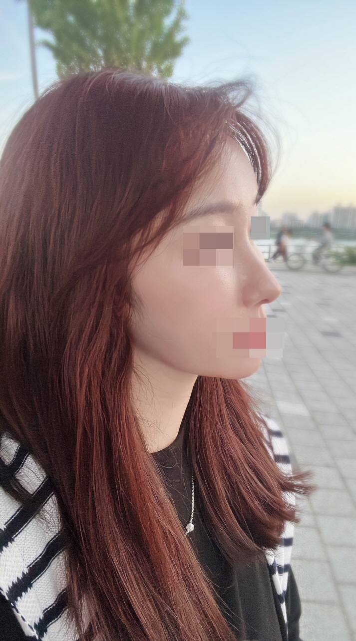 수술후기이미지