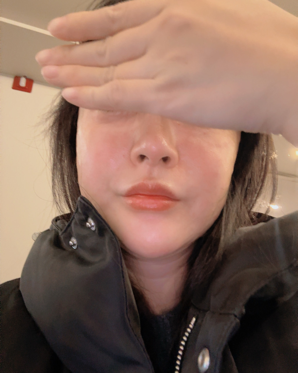 수술후기이미지