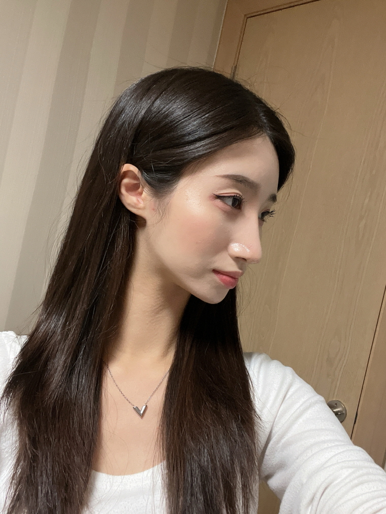 수술후기이미지