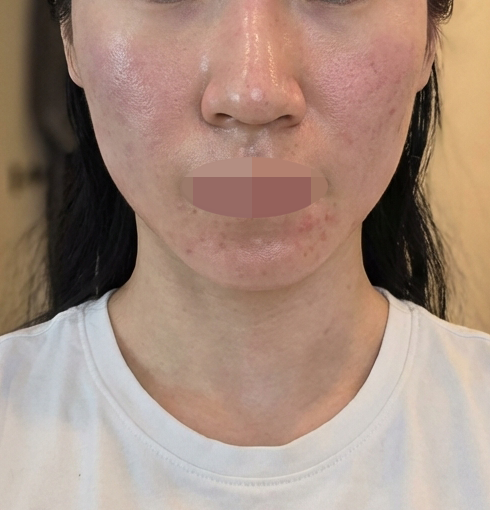 수술후기이미지