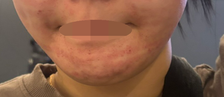 수술후기이미지