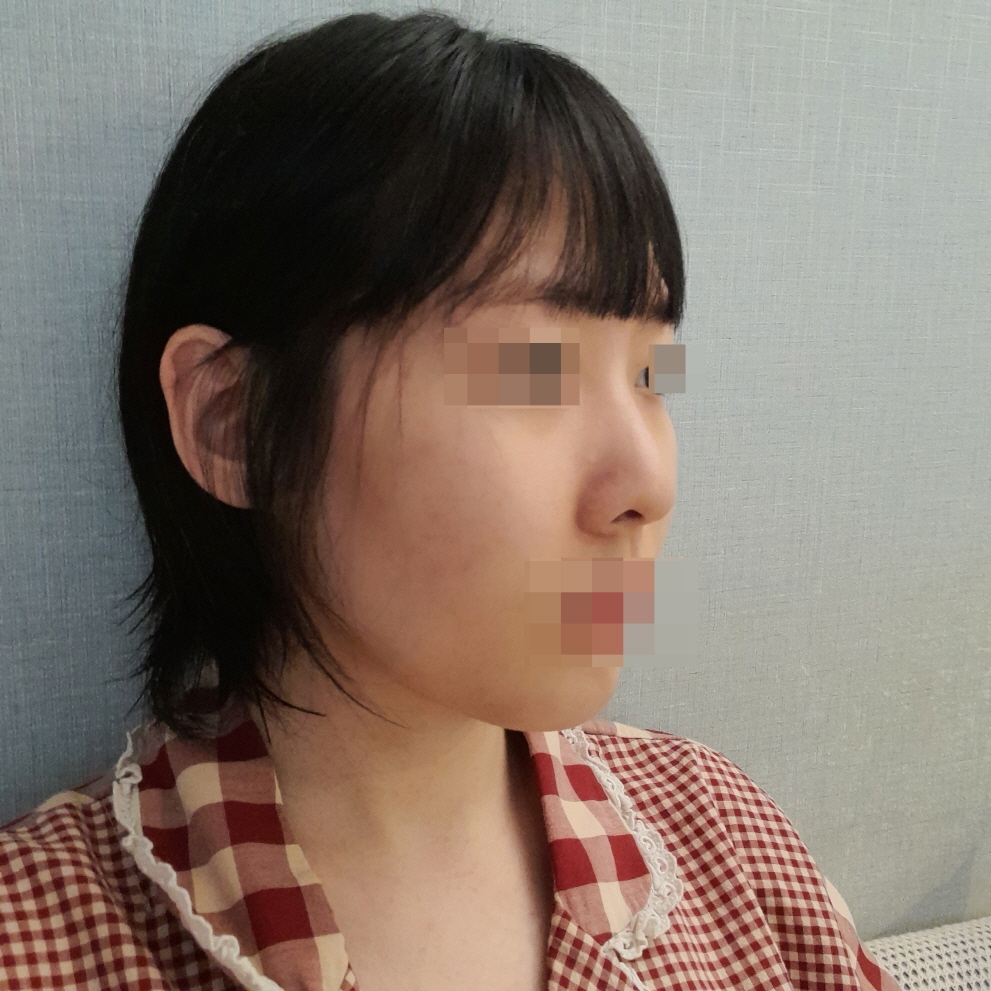 수술후기이미지