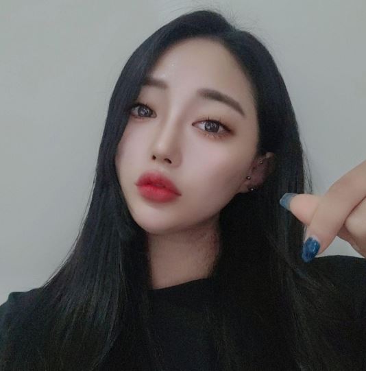 수술후기이미지