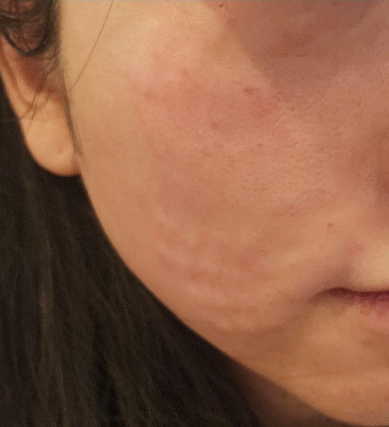 수술후기이미지