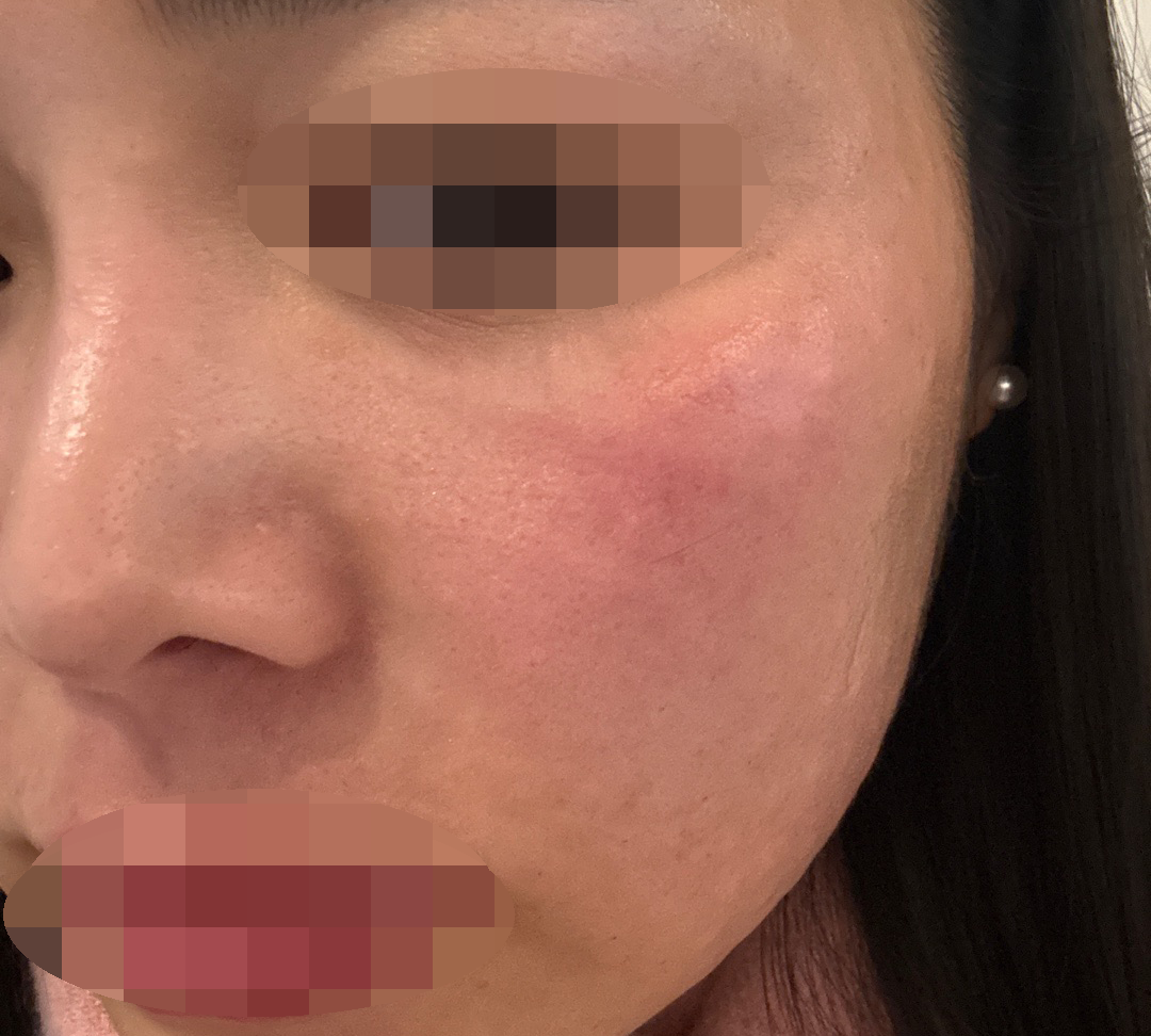 수술후기이미지