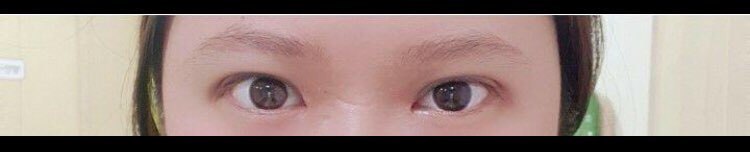 수술후기이미지