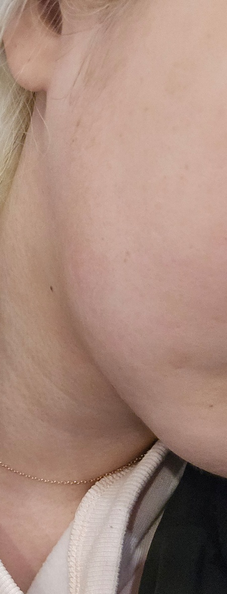 수술후기이미지