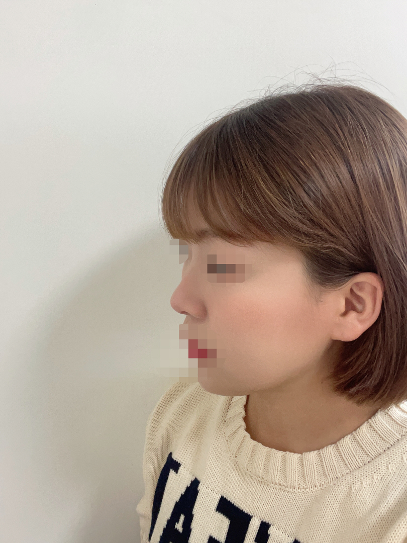 수술후기이미지