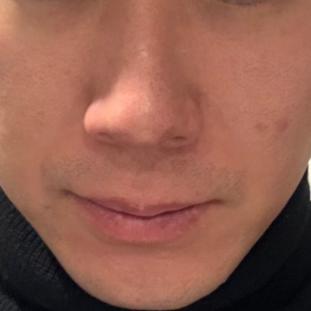 수술후기이미지