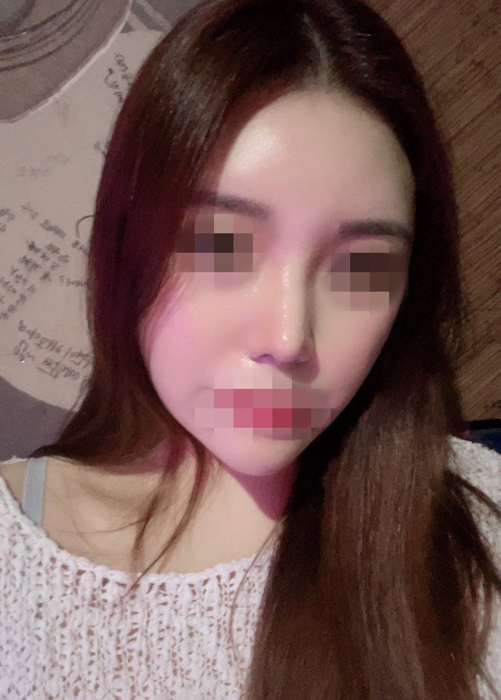 수술후기이미지