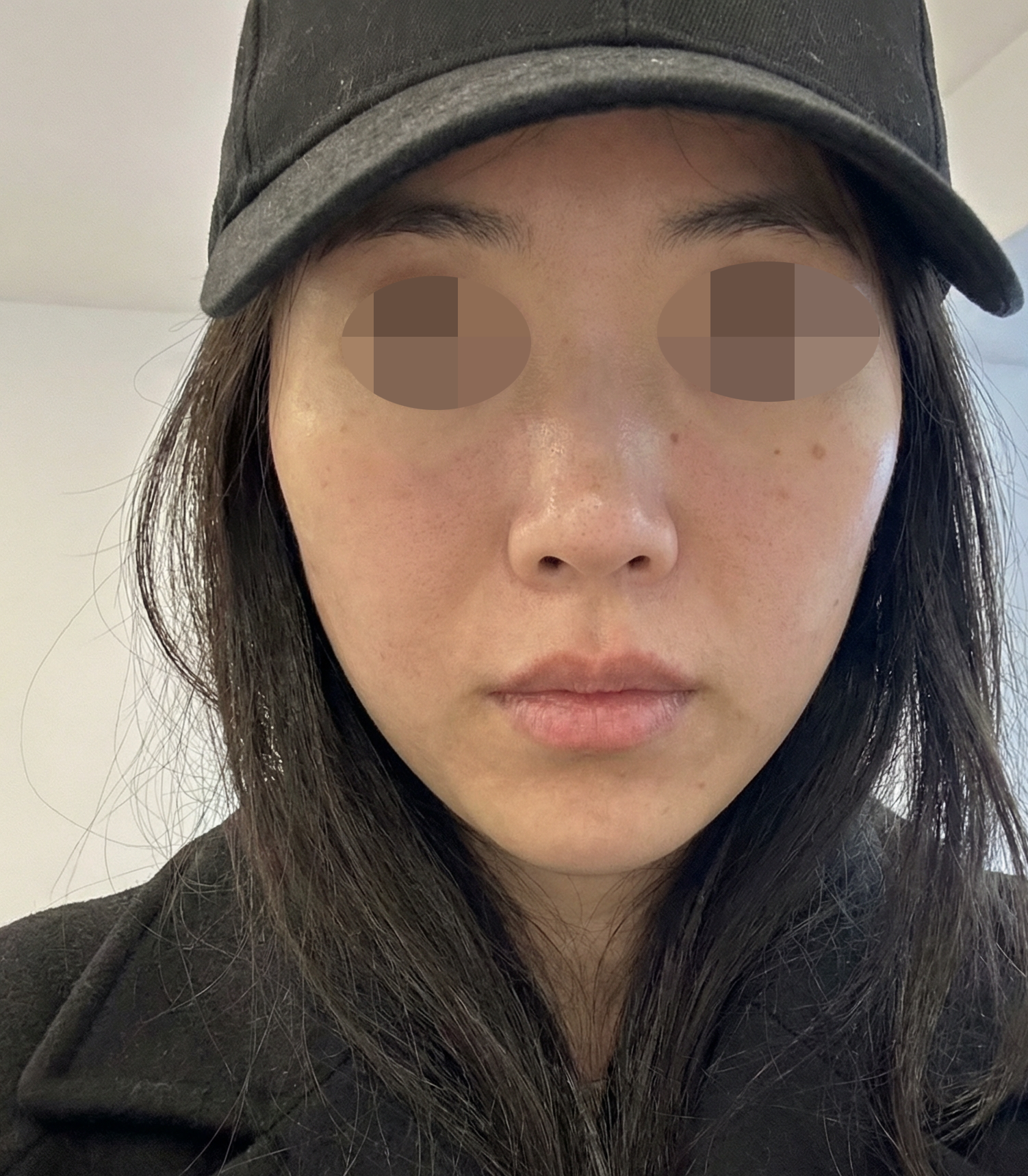 수술후기이미지