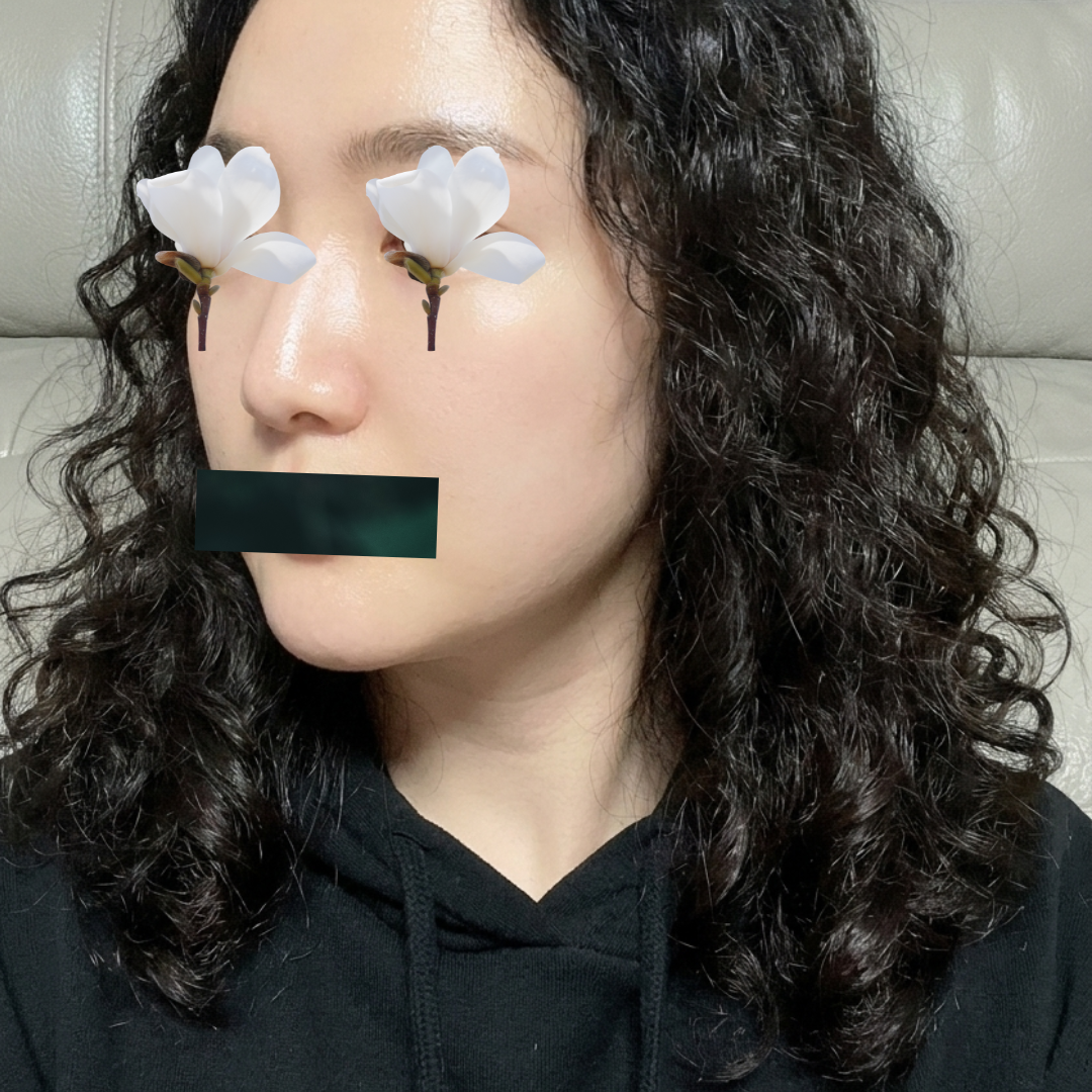 수술후기이미지