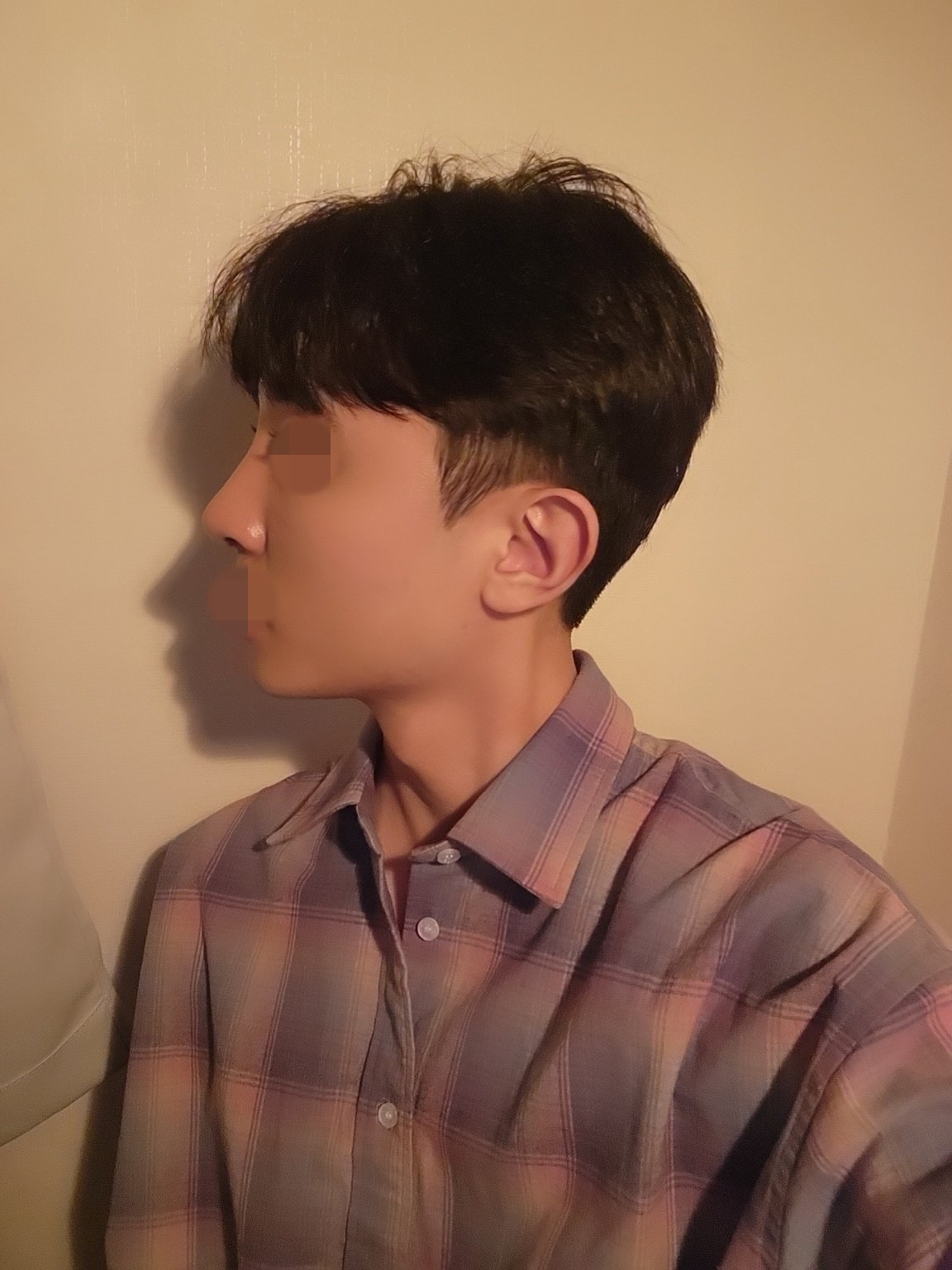 수술후기이미지