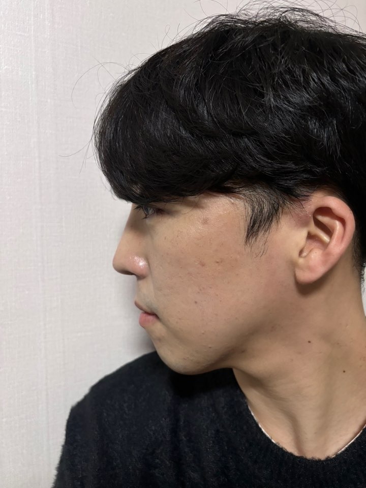 수술후기이미지