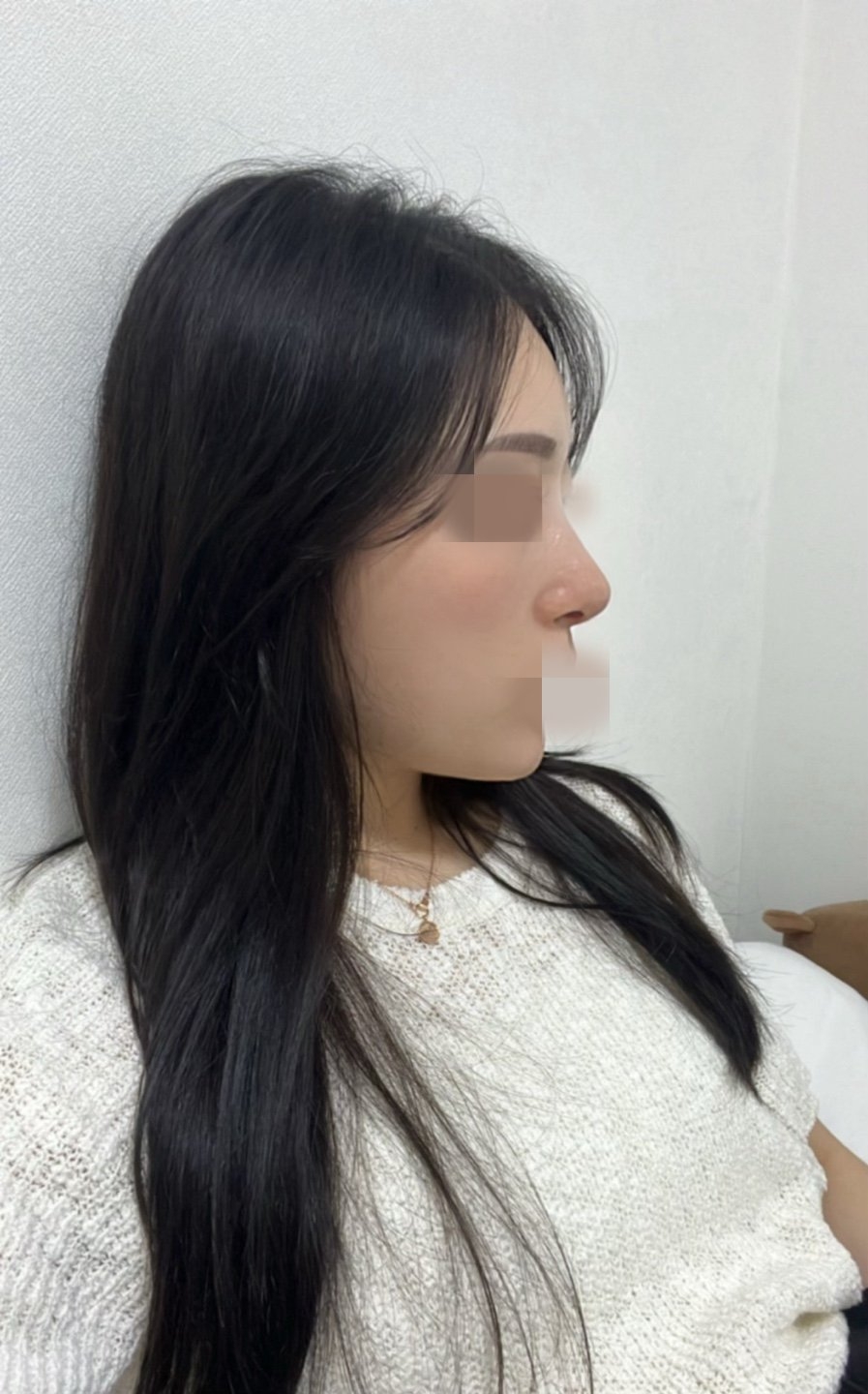 수술후기이미지