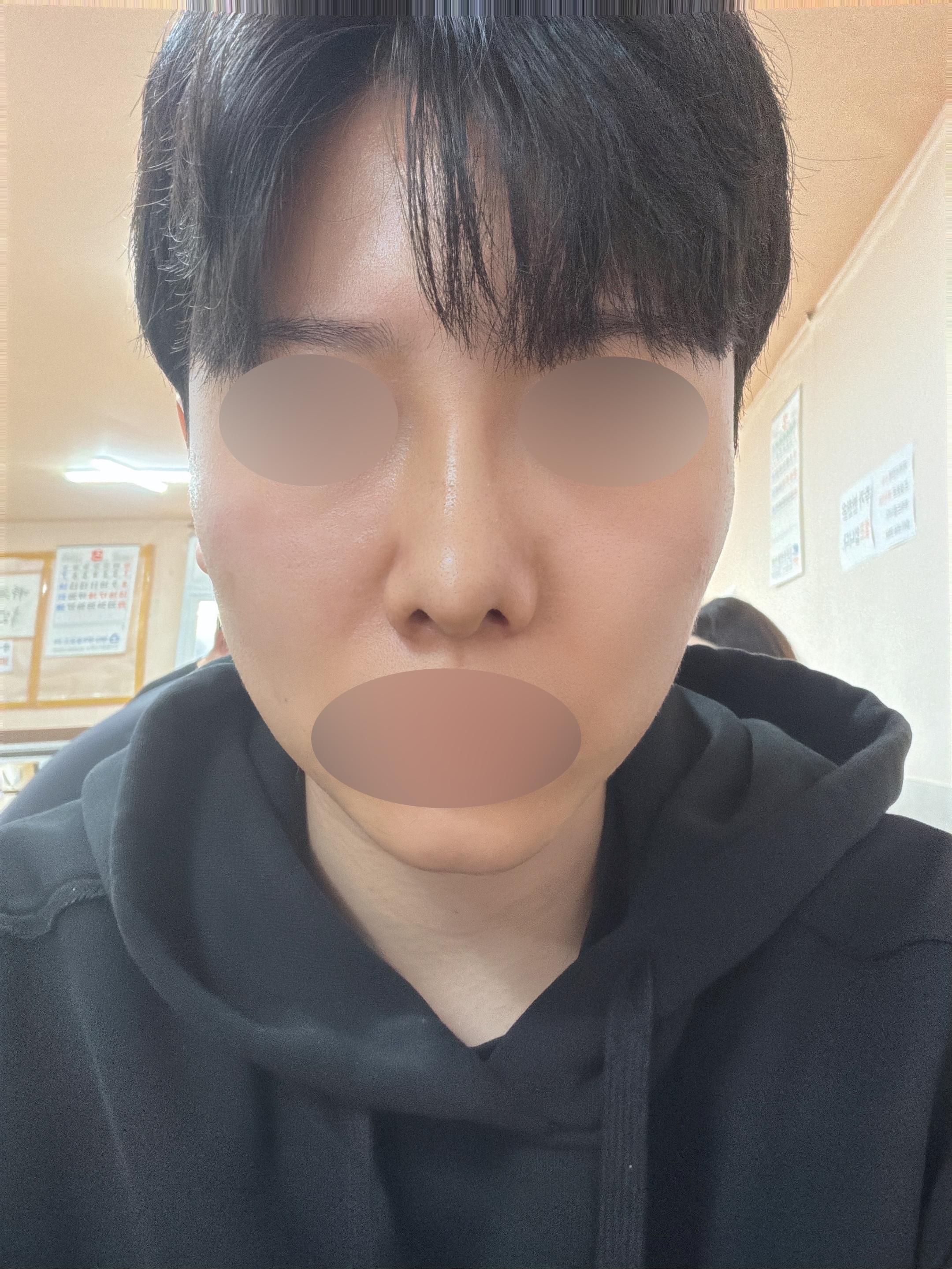 수술후기이미지